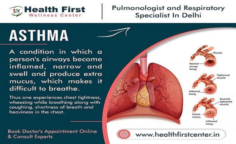 Find The Best Asthma Doctor Near Me – Dr. Sanchayan Roy