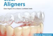 Best Dental Clinic in kothapet,