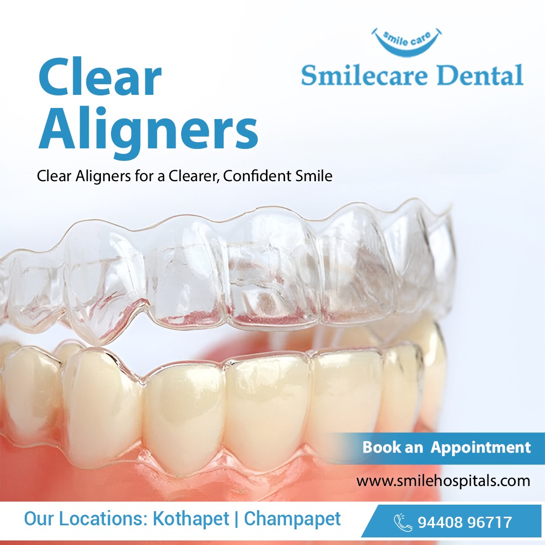 Best Dental Clinic in kothapet,