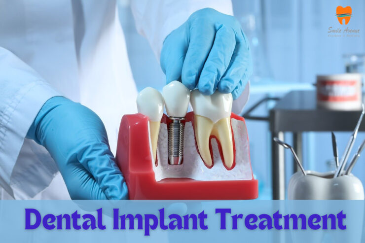 Best Dental Clinic in Noida || Smile Dental Avenue