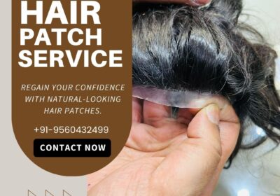 hair-patch-in-delhi