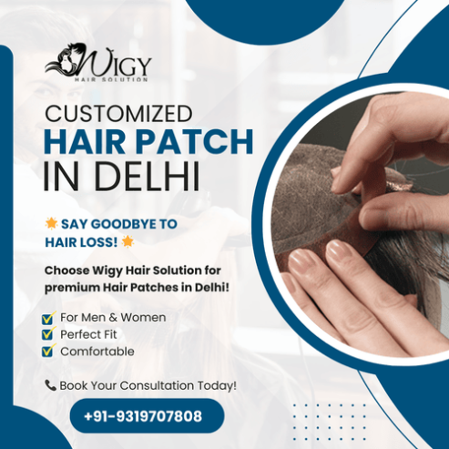 Customized Hair Patch in Delhi – Wigy Hair Solution