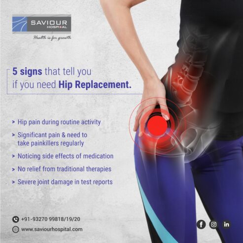 Regain Motion with Best Hip Replacement Surgeon in India