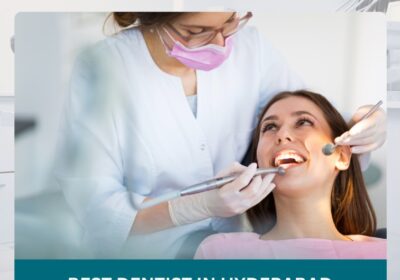 Best-Dentist-in-Hyderabad-2