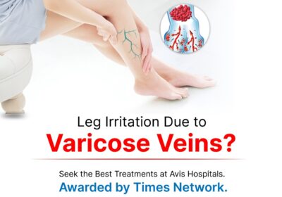 Vascular-Veins-1
