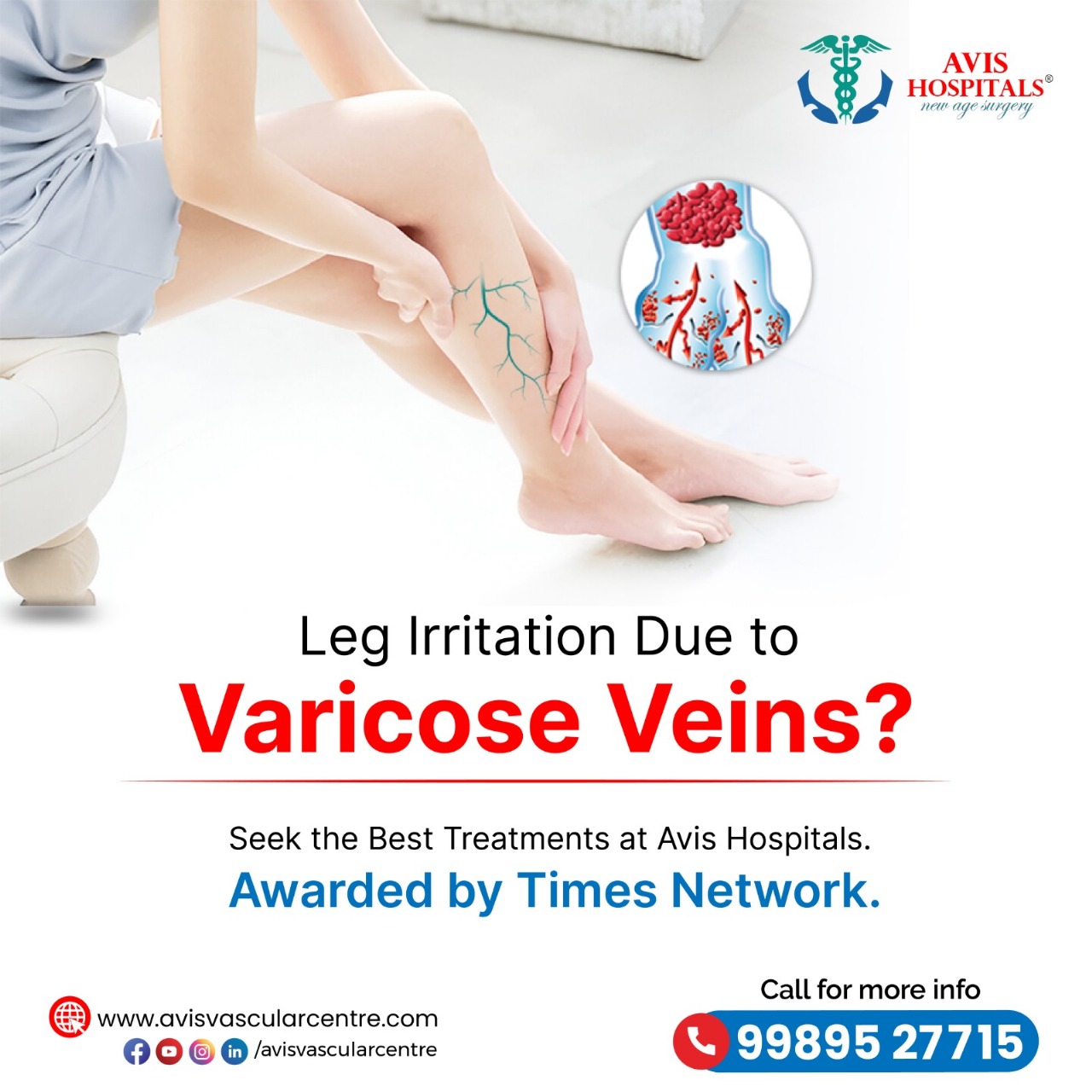 Best and advanced Laser Varicose Veins Treatment in Hyderabad – Avis Vascular Centre