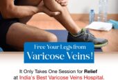 Best and advanced Laser Varicose Veins Treatment in Hyderabad – Avis Vascular Centre