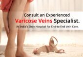 Best and advanced Laser Varicose Veins Treatment in Hyderabad – Avis Vascular Centre