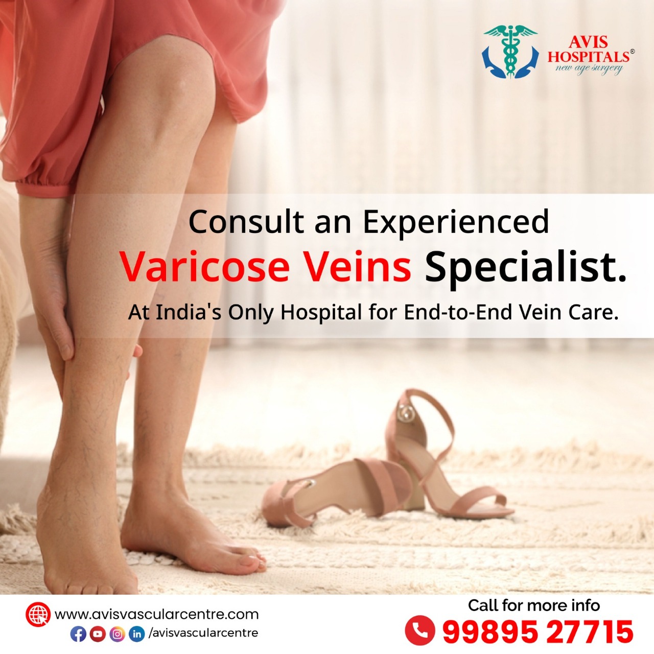 Best and advanced Laser Varicose Veins Treatment in Hyderabad – Avis Vascular Centre
