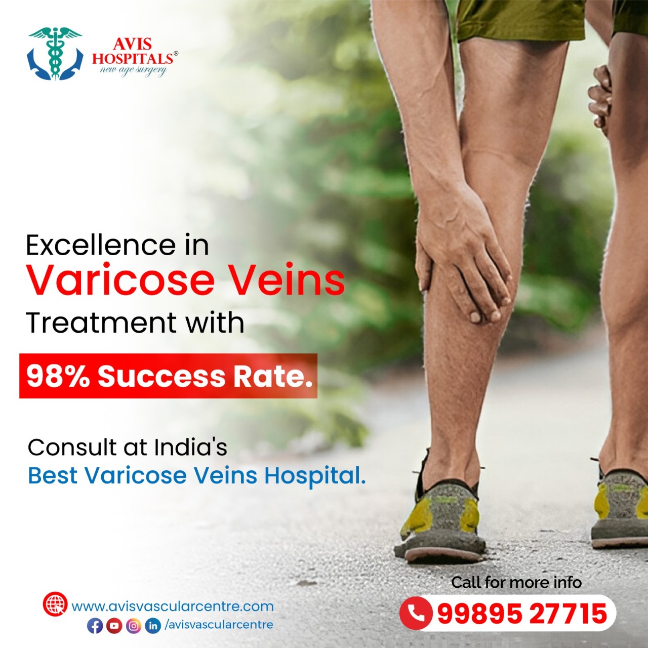 Best and advanced Laser Varicose Veins Treatment in Hyderabad – Avis Vascular Centre
