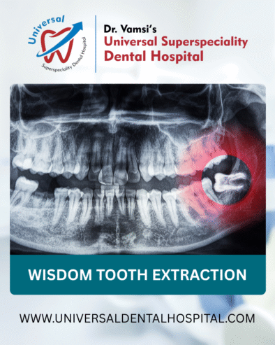Wisdom Tooth Extraction: What to Expect & How to Prepare
