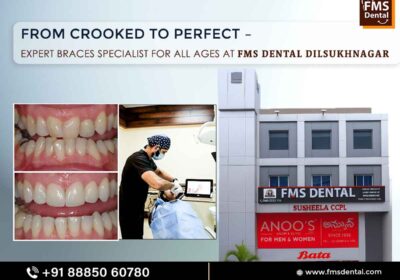 best-braces-specialist-in-Dilsukhnagar-fms-dental_11zon