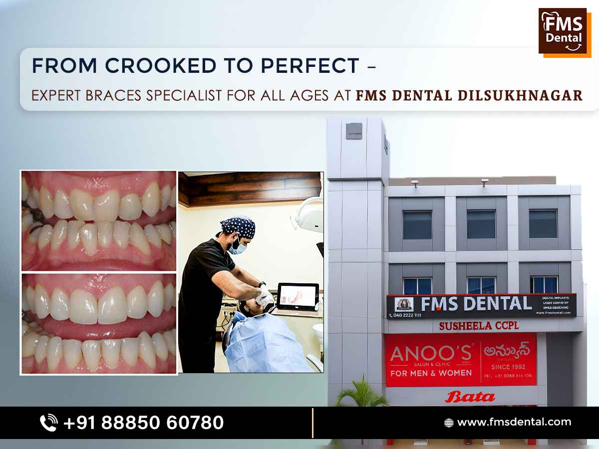 Expert Braces specialist in Dilsukhnagar – FMS Dental