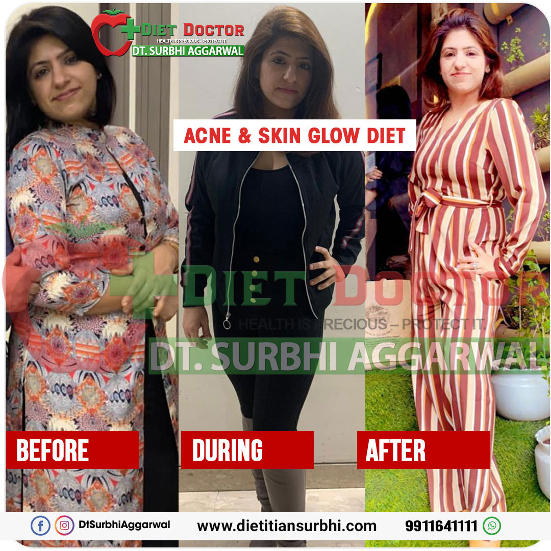 Best Dietitian in Delhi