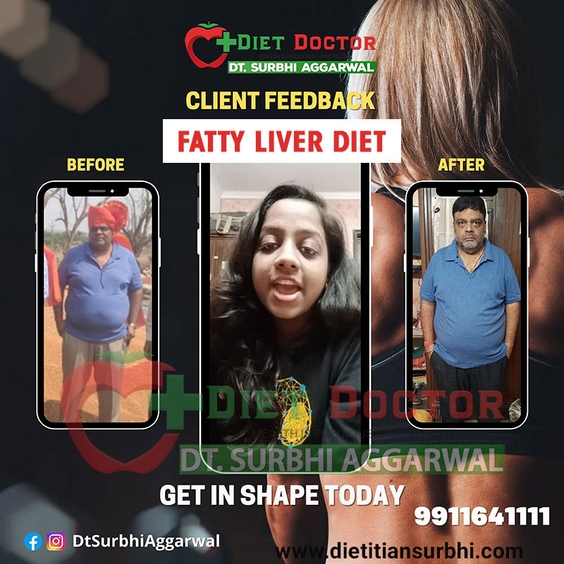 Best Dietitian in Delhi