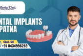 Dental Implants In Patna | Dental Implants Treatment In Patna