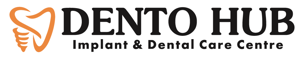 Best Dental Implant Clinic in Delhi | Vikaspuri • Janakpuri • Tilak Nagar, West Delhi