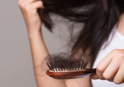 Hair-Loss-Treatment-Clinic